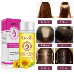 Hair Growth Essence – Anti Hair Loss Essential Oil Treatment 20ml