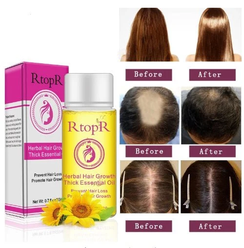 Hair Growth Essence – Anti Hair Loss Essential Oil Treatment 20ml