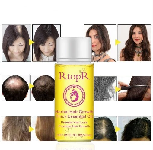 Hair Growth Essence – Anti Hair Loss Essential Oil Treatment 20ml