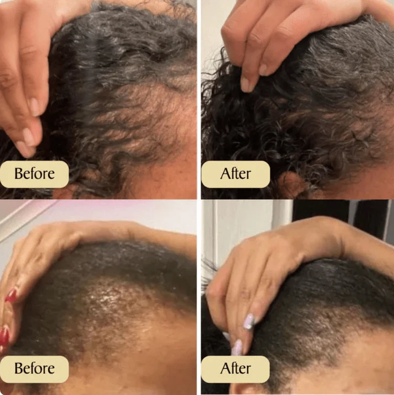 Hair Growth Oil – Natural Hair Nourishing & Anti-Hair Loss Treatment with Rosemary, Castor & Argan Oil 60ml