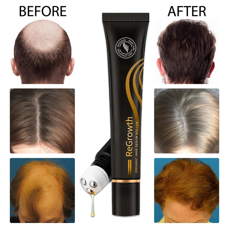 Hair Growth Nourishing Serum – Anti-Hair Loss Scalp Treatment Liquid 20ml