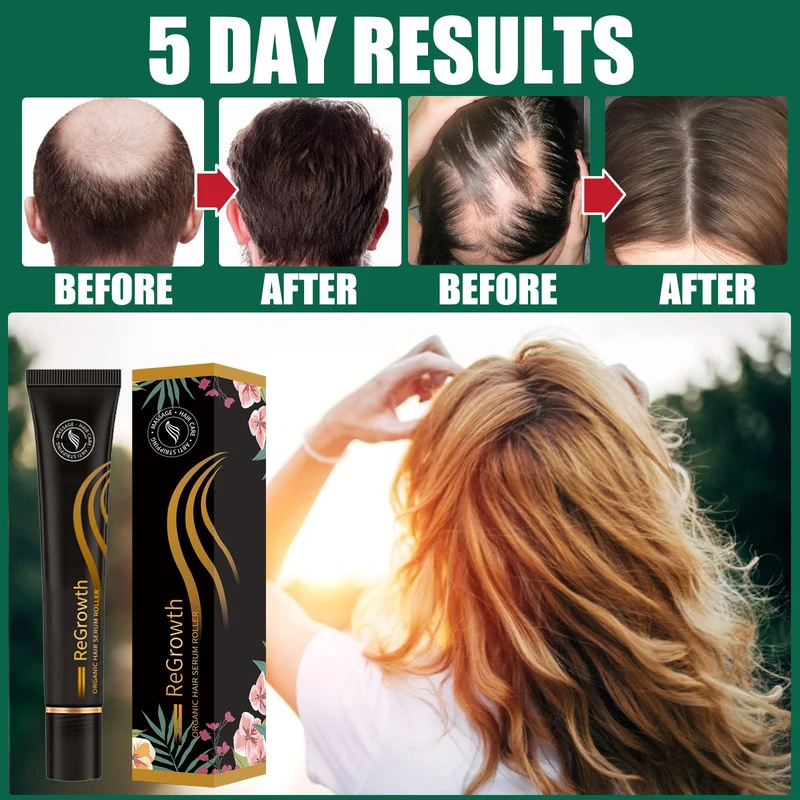 Hair Growth Nourishing Serum – Anti-Hair Loss Scalp Treatment Liquid 20ml