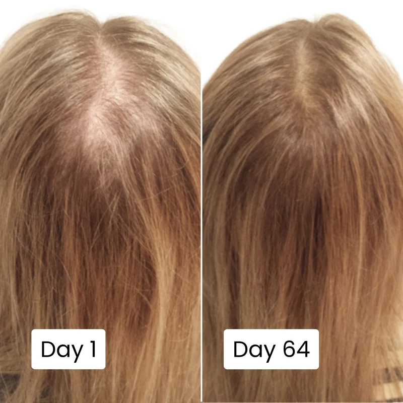 Scalp Hair Growth Serum