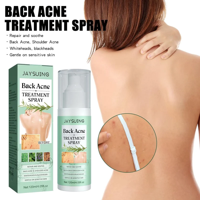 JAYSUING Back Acne Treatment Spray (120ml / 4.05 fl.oz)