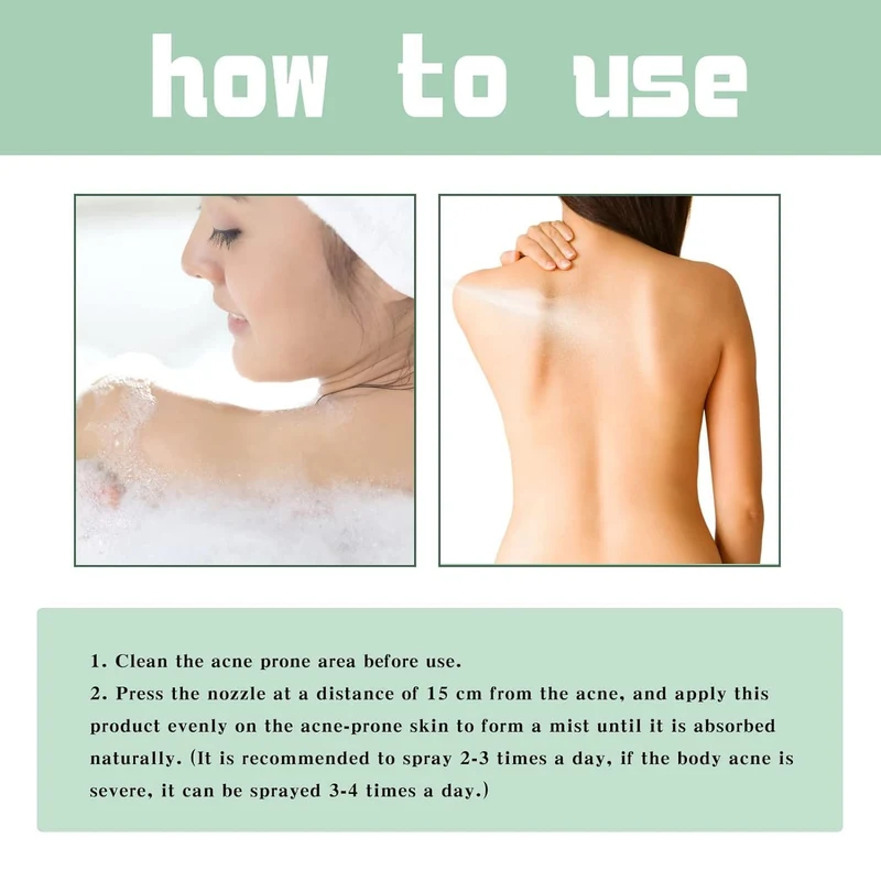 JAYSUING Back Acne Treatment Spray (120ml / 4.05 fl.oz)