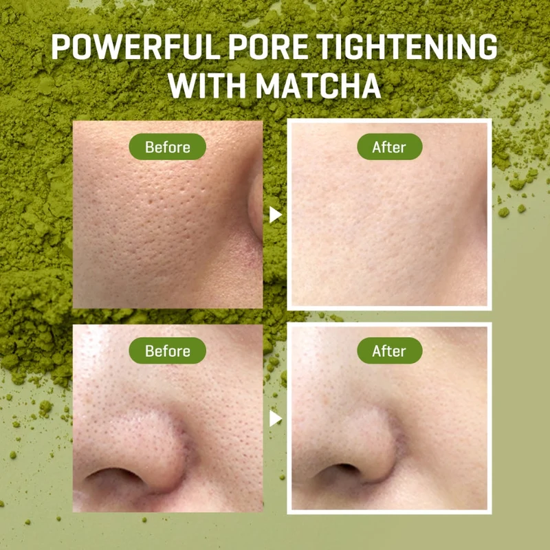 SOME BY MI Super Matcha Pore Care Starter Kit