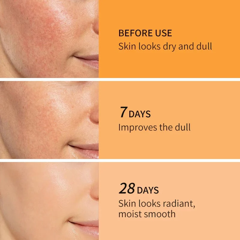 KORMESIC Retinol + Tocopherol Anti-Wrinkle & Repairing Night Cream (30g / 1.06 oz.)