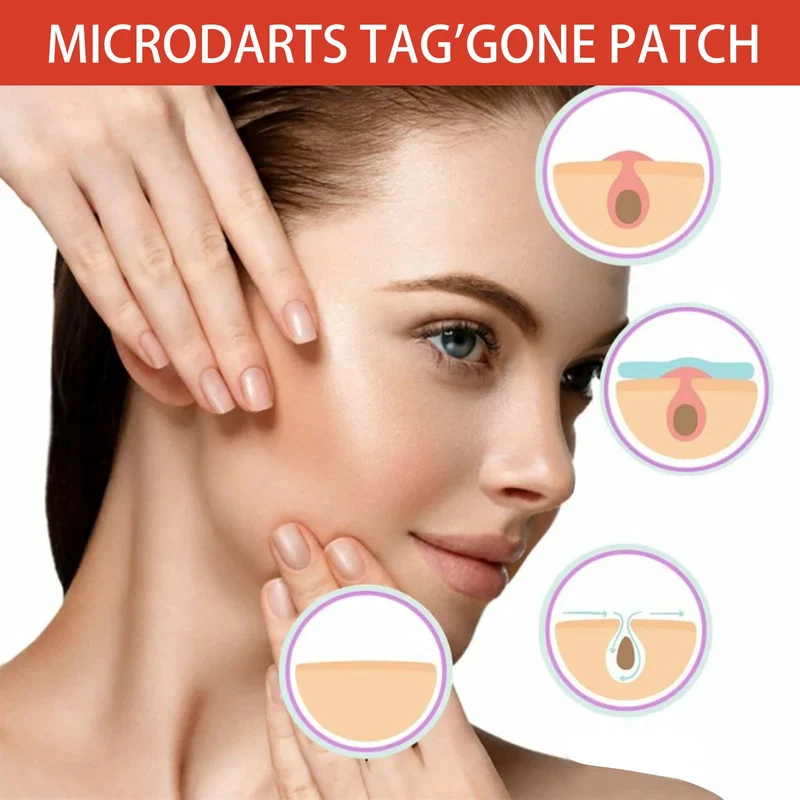 Micro Darts Tag 'Gone Patch (144 Patches)