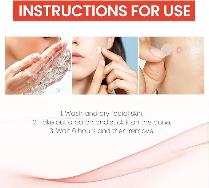 Hydrocolloid Acne Cover Patch (72 Transparent Patches)