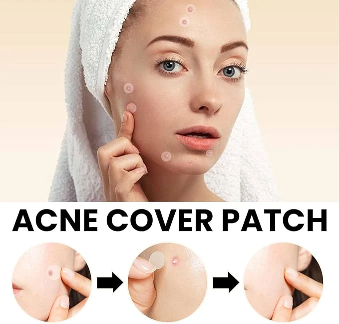 Hydrocolloid Acne Cover Patch (72 Transparent Patches)
