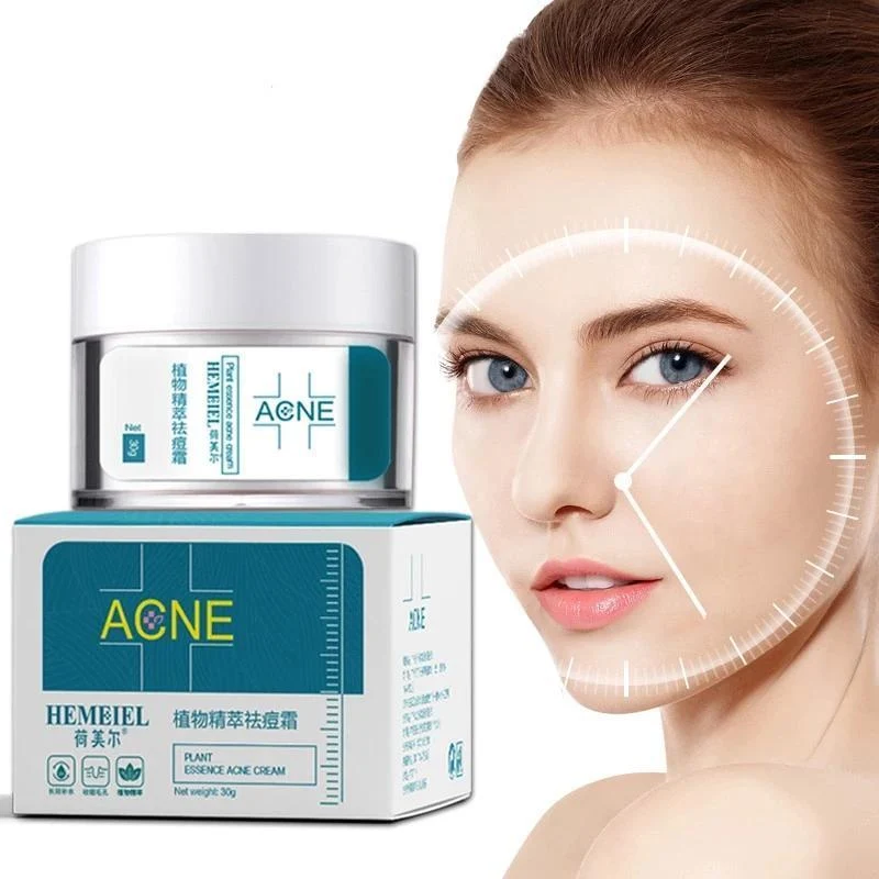 HEMEIEL Plant Essence Acne Cream – 30g