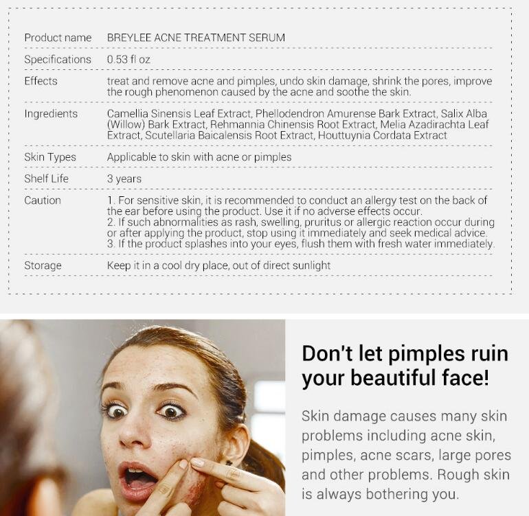 BREYLEE Acne Treatment Serum (17ml / 0.6 fl oz)