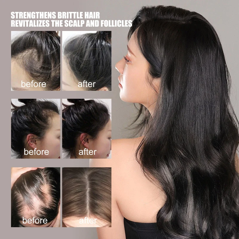 West & Month Hair Growth Serum