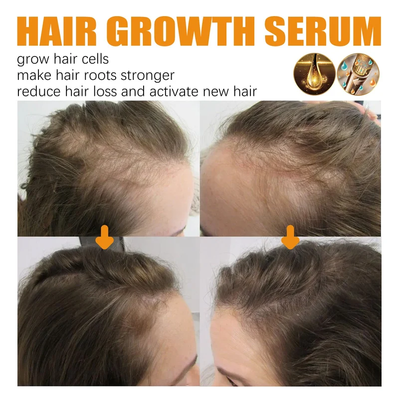 West & Month Hair Growth Serum