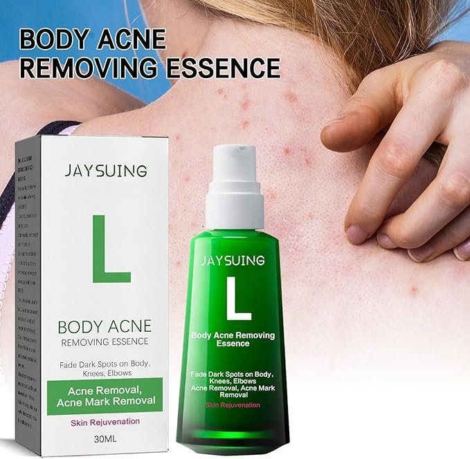 Jaysuing Body Acne Removing Essence (30ml)