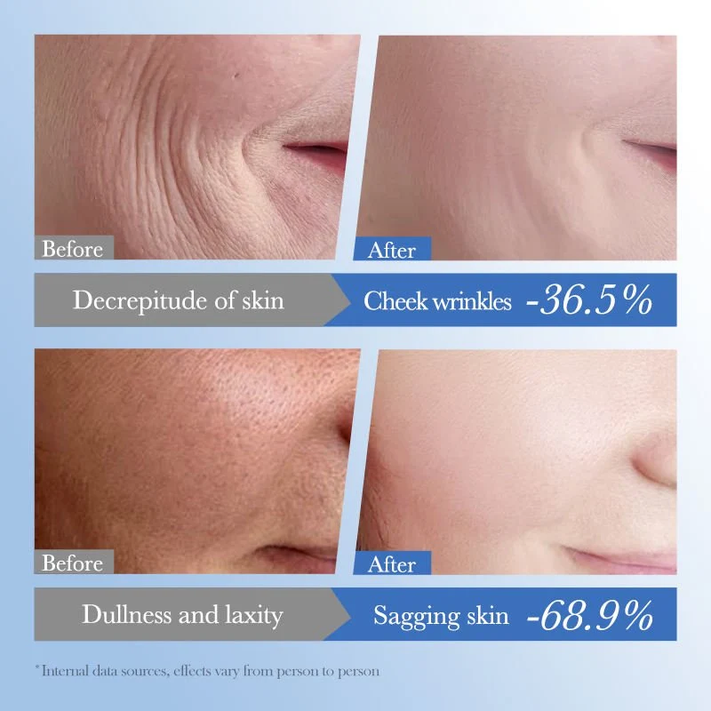 SADOER Caviar + HA Anti-Aging Repair Moisturizer Cream (55g / 1.94 fl. oz.)