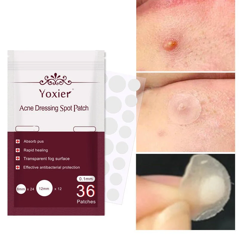 Yoxier Acne Dressing Spot Patch – Invisible Pimple Stickers (36 Patches)