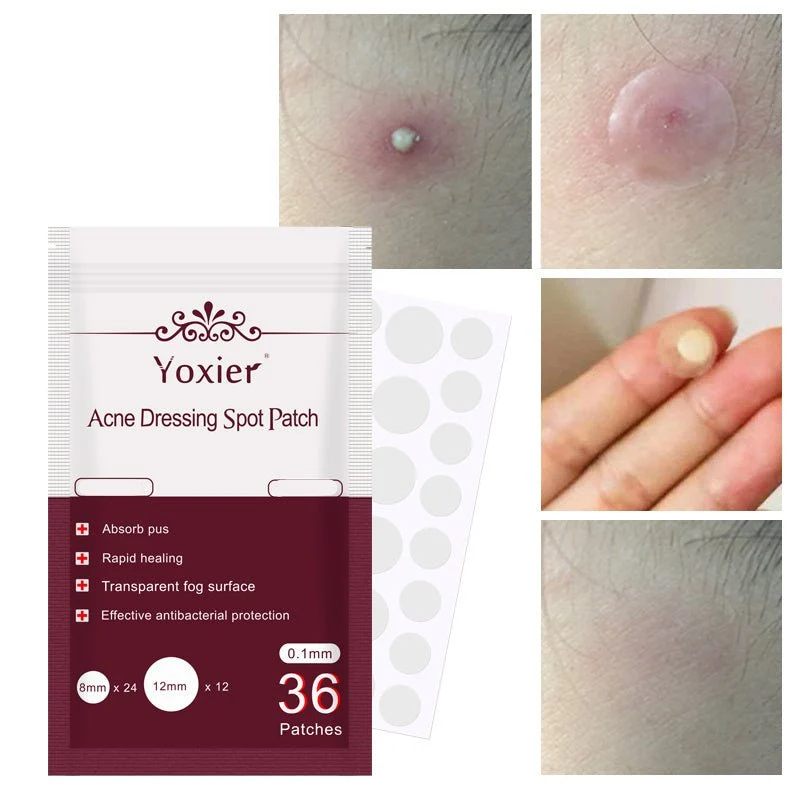 Yoxier Acne Dressing Spot Patch – Invisible Pimple Stickers (36 Patches)