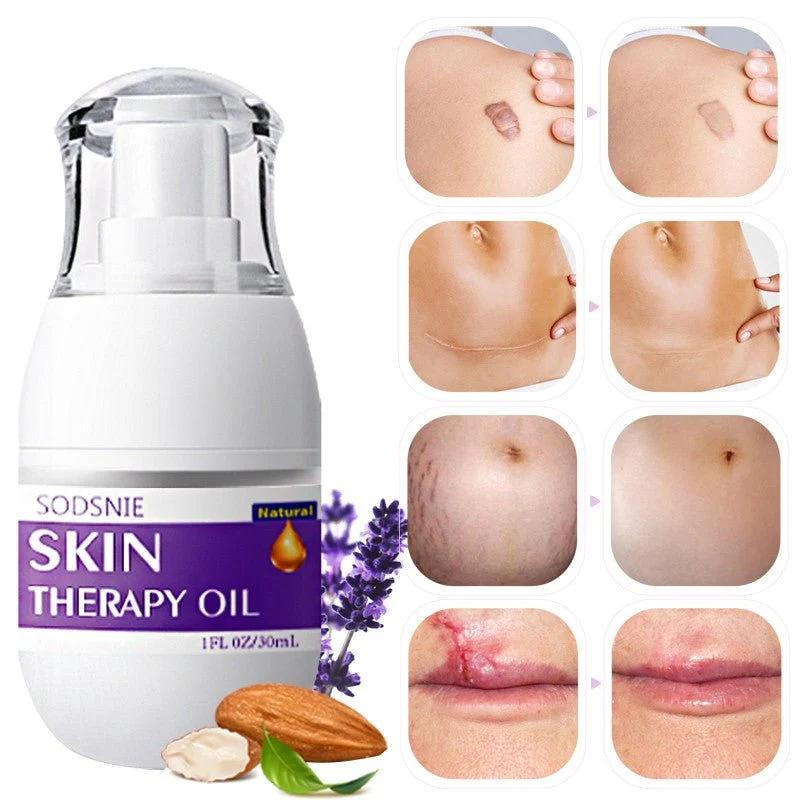 SODSNIE Natural Skin Therapy Oil