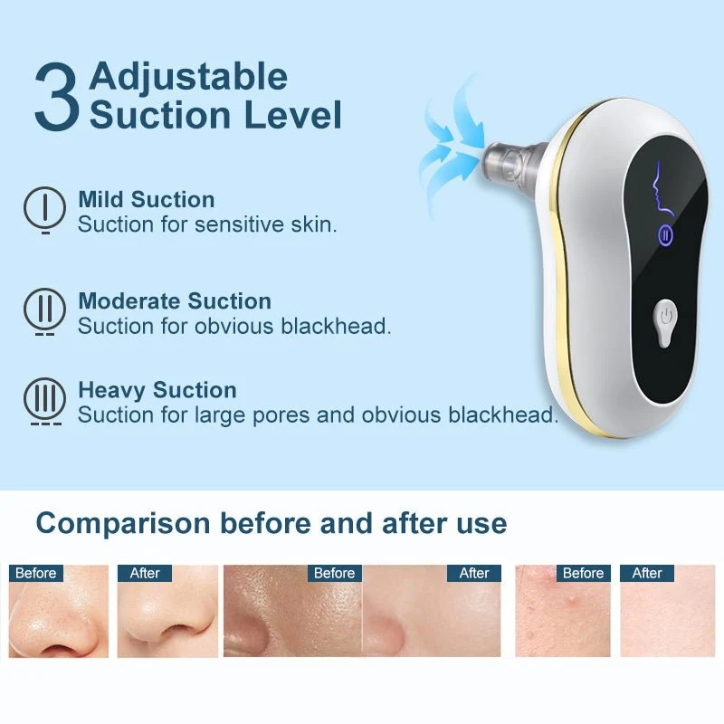 Electric Facial Pore Vacuum & Blackhead Remover Kit