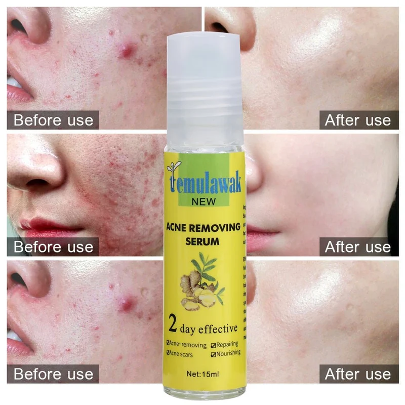 Temulawak New Acne Removing Serum (15ml)