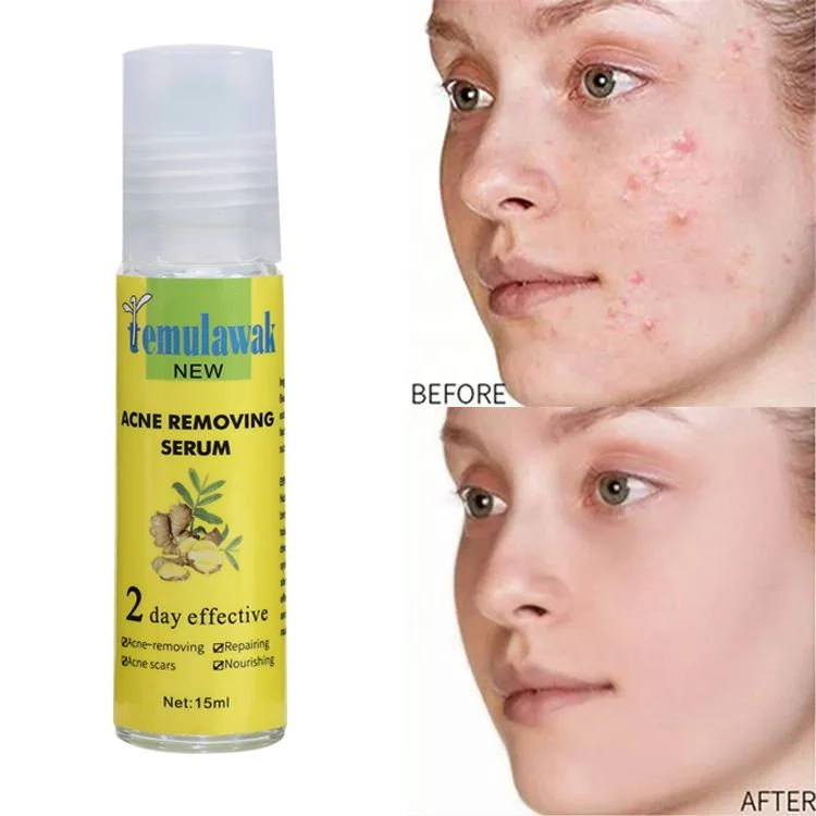 Temulawak New Acne Removing Serum (15ml)